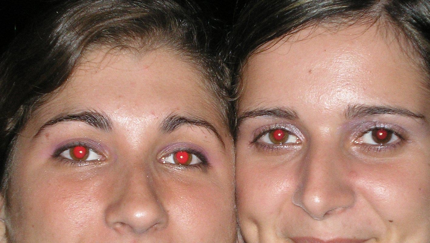 Como quitar los ojos rojos Como quitar los ojos rojos