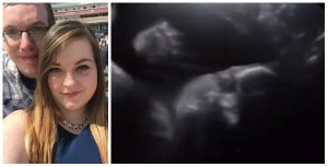  un bebé parece voltear y saludar sus papás ¡a través de una ecografía!