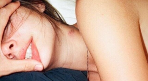 ¿Te mordió un vampiro? Aquí las mejores maneras de quitar un chupetón