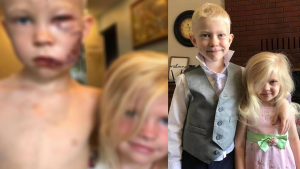 Pequeño héroe sin capa es muy valiente y salva la vida de su hermanita