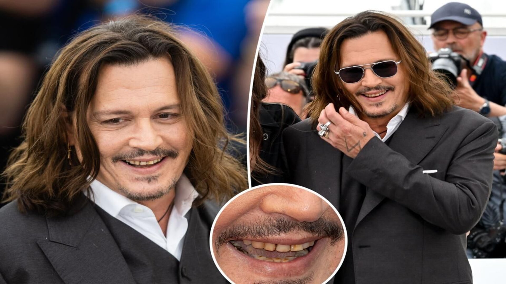 Johnny Depp impacta en Cannes con sus dientes en mal estado