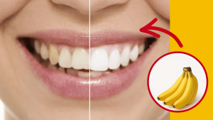 Blanquear dientes con cáscara de plátano